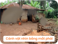 Hội chứng glaucoma